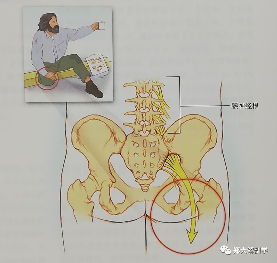 七種引起髖關節和下肢的疼痛綜合徵