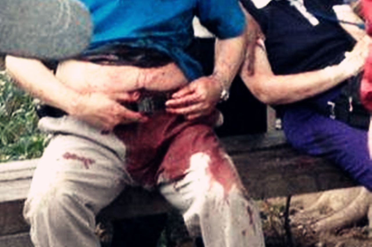 梦境解析,梦见铁棍子在腹部插着,无痛无血,寓意何在? 梦境解析,梦见铁棍子在腹部插着,无痛无血,寓意何在?