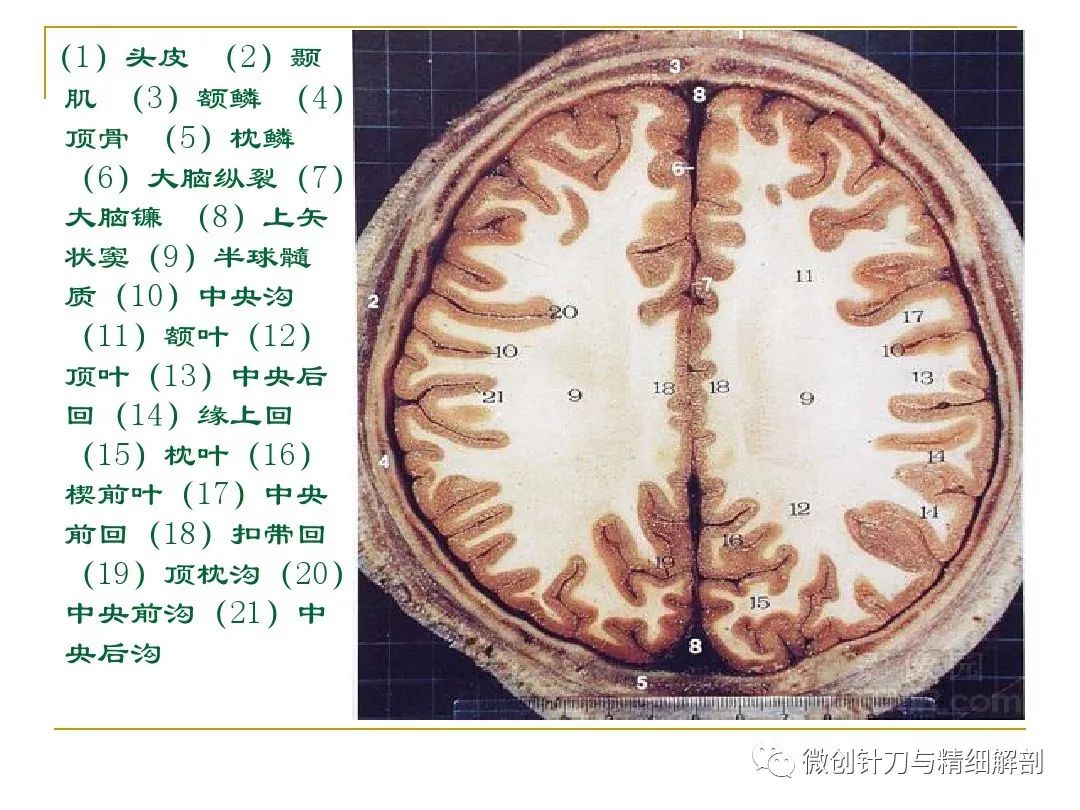 半卵圆中心手绘图图片