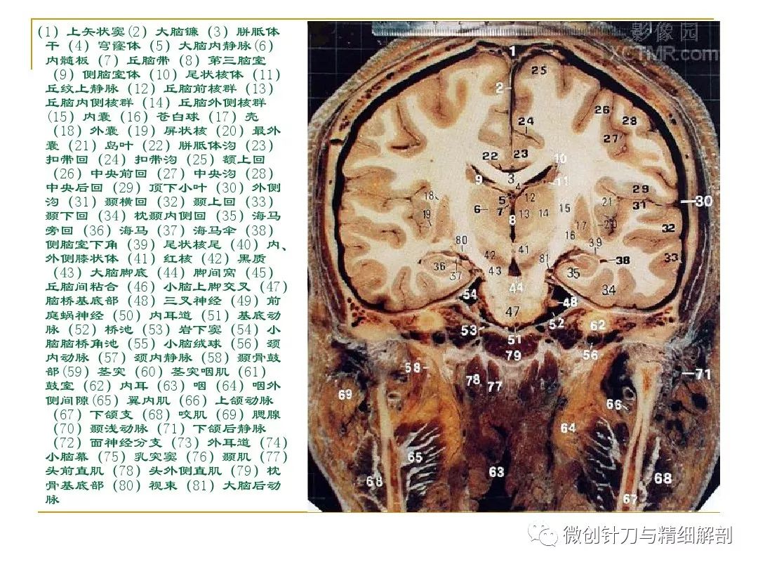 人体断层解剖图谱