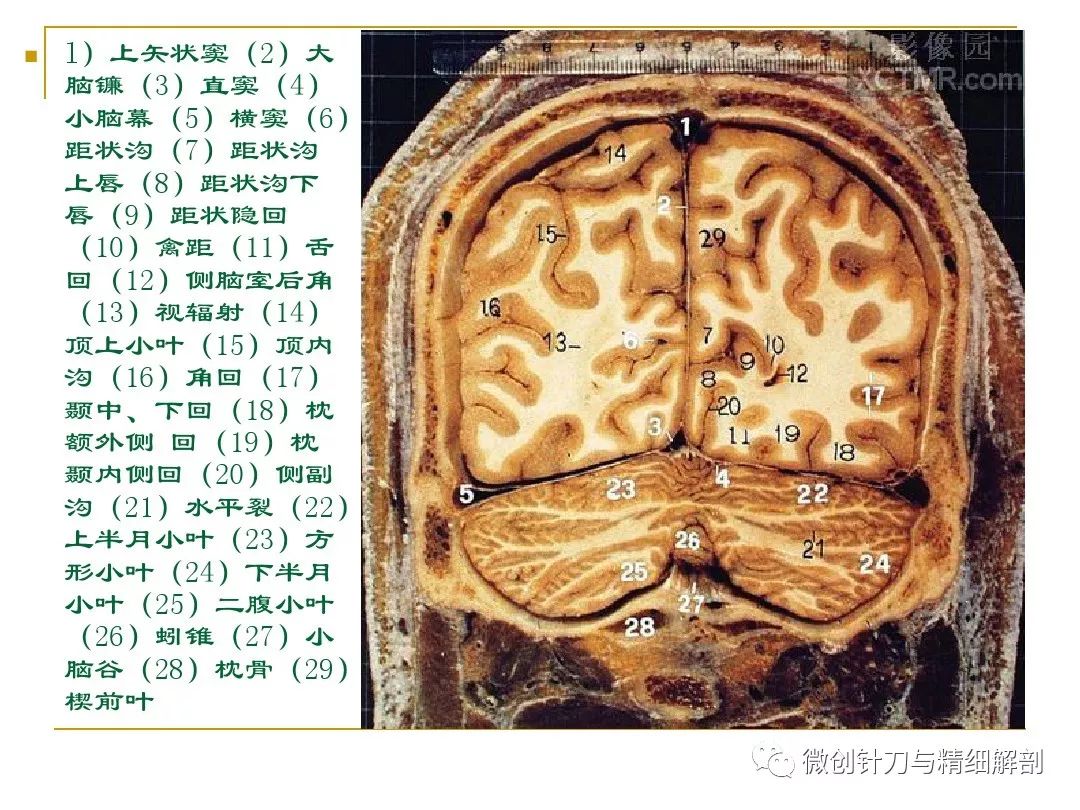 人体断层解剖图谱