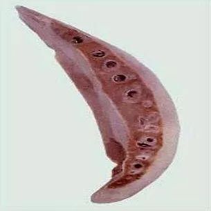 女子大腿小腿阴道里长满虫子全是因为吃了它很多人都爱吃