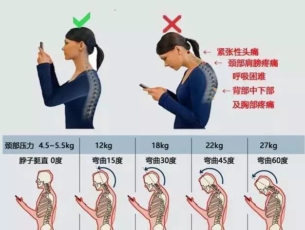 低頭玩手機脖子酸脹太難受抹一抹這個東西立馬舒暢勝過10個老中醫比