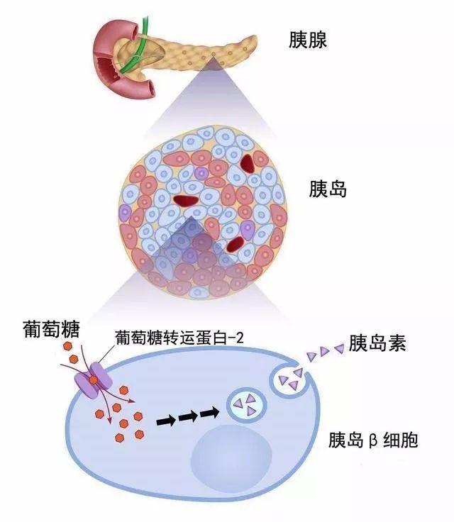 你的胰岛还好吗