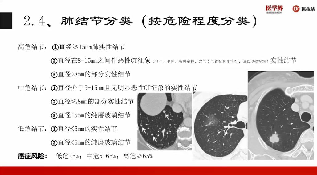 一文教你理清肺结节的分类