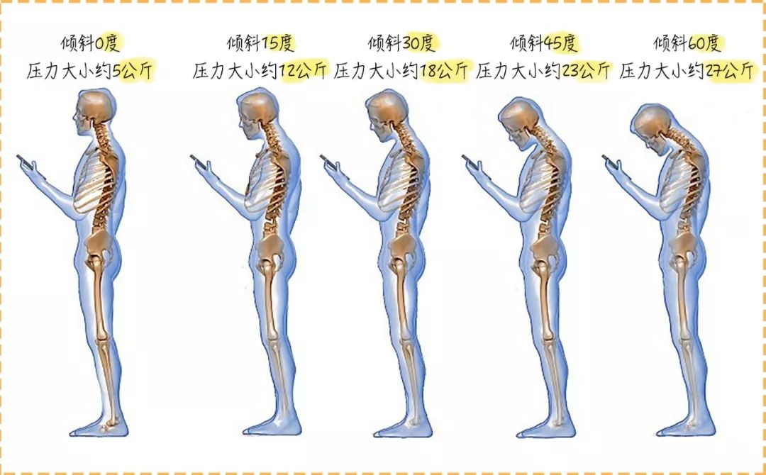 身体重心在侧边,脊柱不是垂直的而大多数人的坐姿其实都是上面两种