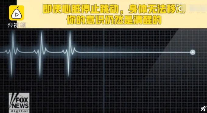 e句话看天下丨心脏停跳大脑还在运转你接受得了吗