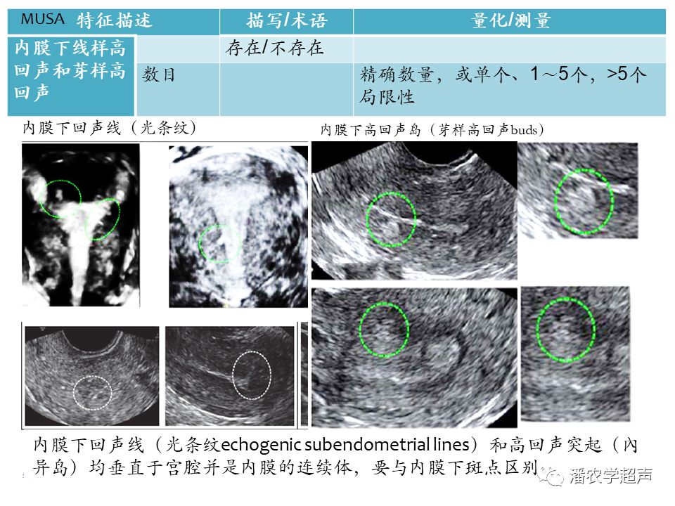 生育力低下子宫内膜常规超声评估