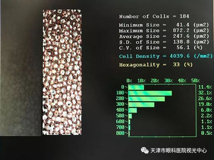 角膜内皮细胞计数图片