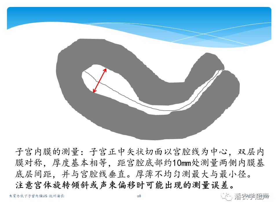 生育力低下子宫内膜常规超声评估