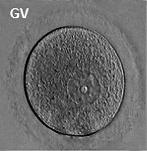 gv卵:gv期的卵母细胞没有恢复减数分裂,将颗粒膜细胞去掉后可以看到