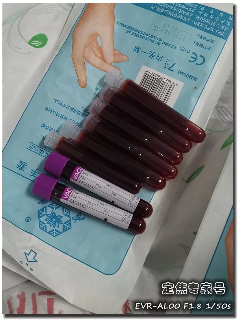 帅男孩爬山回家莫名低烧,一周后从心口抽出一大瓶血红色液体