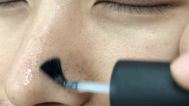 画面极度舒适十几年顽固老黑头30秒彻底连根拔起毛孔畅快呼吸原来是