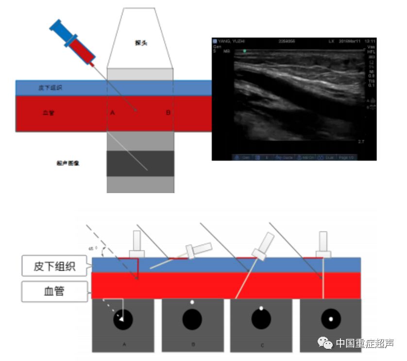 重症超声规范化诊治流程7
