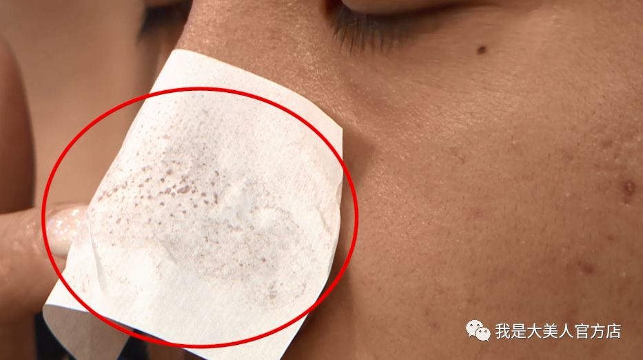 画面极度舒适十几年顽固老黑头30秒彻底连根拔起毛孔畅快呼吸原来是