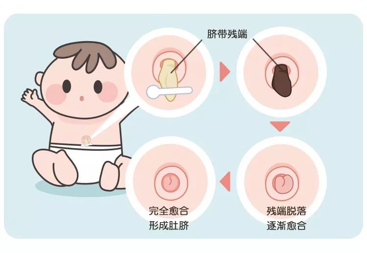 肚脐到底是什么样的