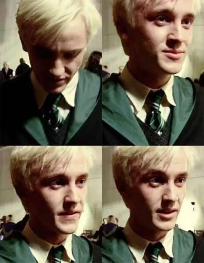 长大之后的"马尔福"发量逐渐消失.