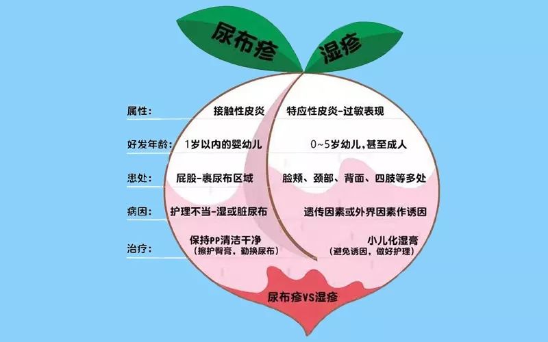 尿布疹反反复复妈妈烦恼宝宝煎熬快收下这份预防宝典