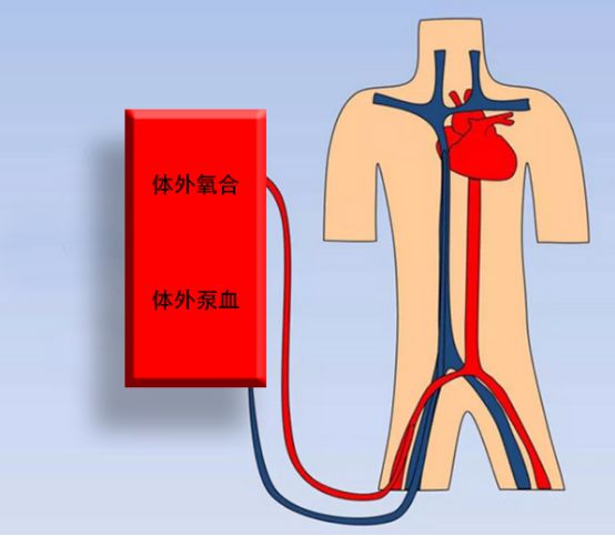 【深度】搏动式电磁血泵电控系统的研究