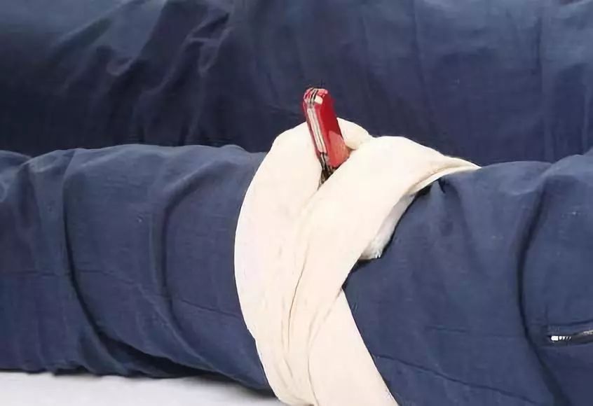 惊险北海一工人被钢筋贯穿身体擦过心脏