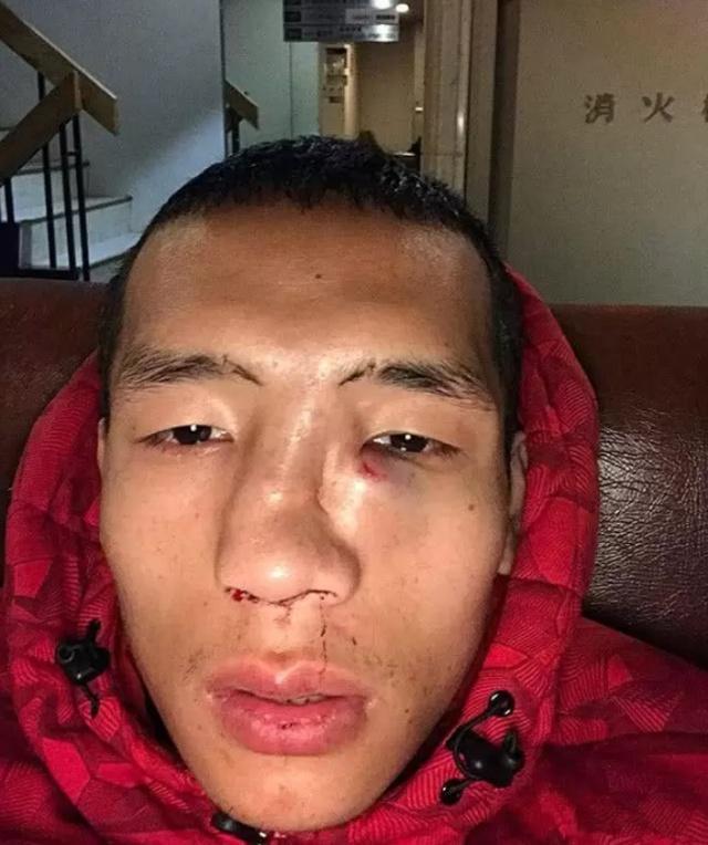 原创中日拳击再起风云0比5输给日本这次我们能复仇么