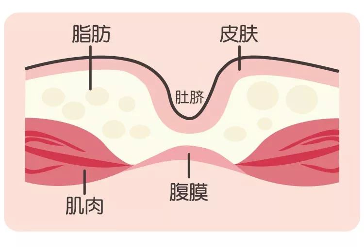 肚脐眼生理结构图图片