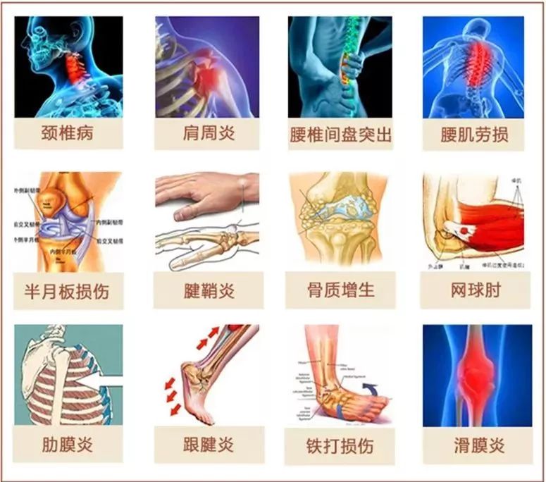 贴到身上,直接渗透皮肤表面,直达痛点,小伤小痛什么的分分钟帮你搞定!