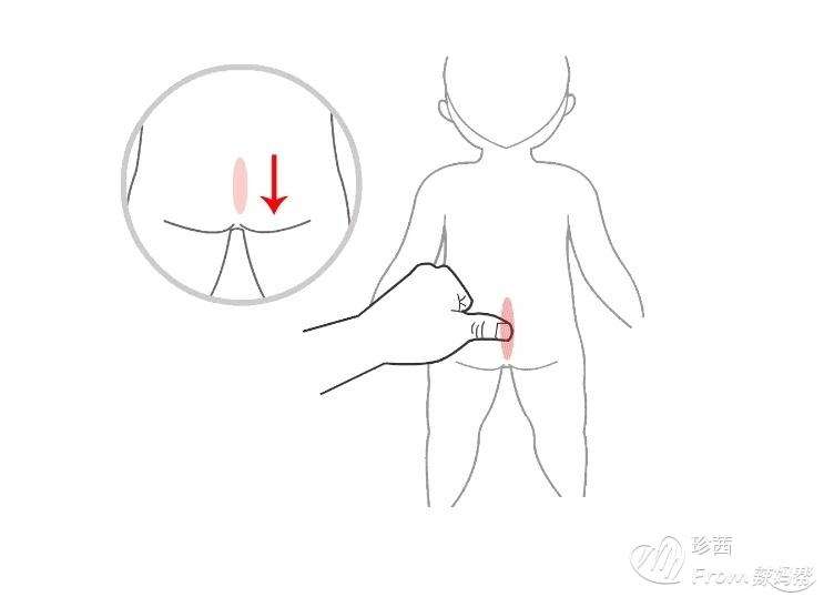 宝宝肠绞痛晚上哭闹怎么办葆合元小儿推拿