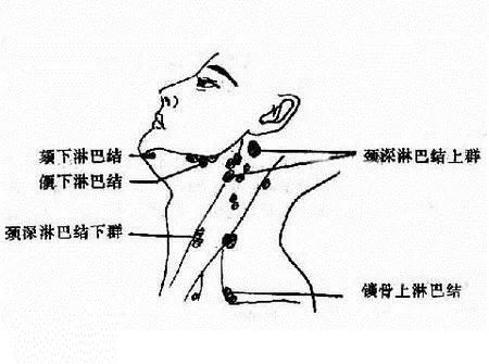 侧枝盲端图片