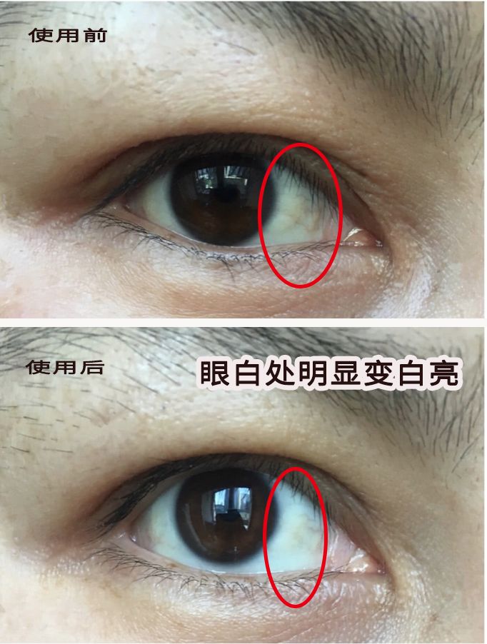 护眼黑科技3秒发热25分钟蒸汽热敷熬夜也有星星眼