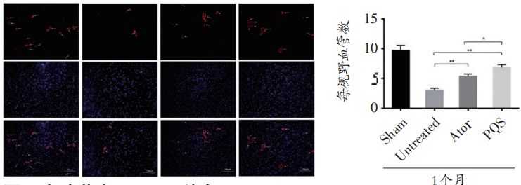 心悦胶囊:改善小型猪慢性心肌缺血导致的心肌损伤