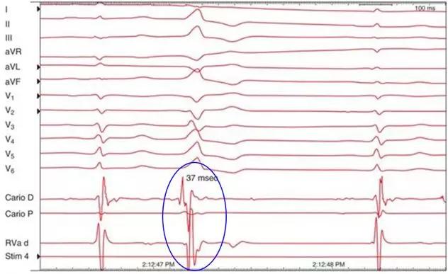 心事谁人知ecgppg穿戴式装置的机会与延伸测试
