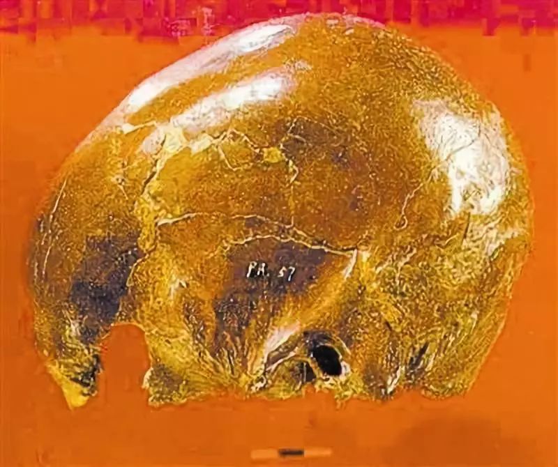 3月17日资阳县九曲河工地发掘出破损的人头骨化石.