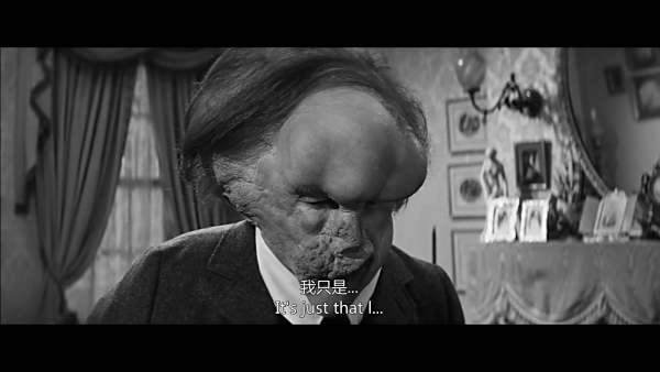 个"象人",一生只碰过一个女人,死后原因成谜,遗体和开膛手有关_梅里克