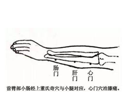 膝關節痛針灸療法針刺放血