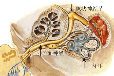 首大李健东耳带状疱疹面瘫不仅要及时治疗还要有足够的耐心