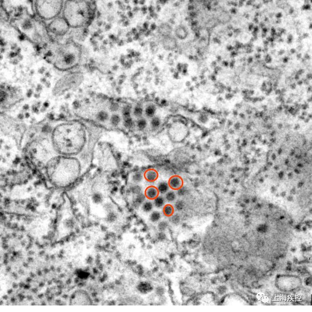 圖1. 電鏡下的登革病毒粒子