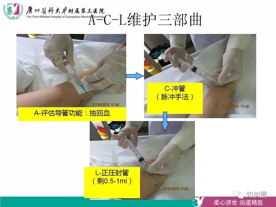 ppt靜脈留置針穿刺技術及靜脈管道的維護