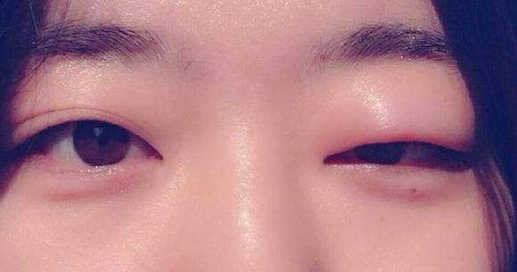 都占陶主任:晨起眼肿,饭后胃胀,舌苔白腻,体寒的女