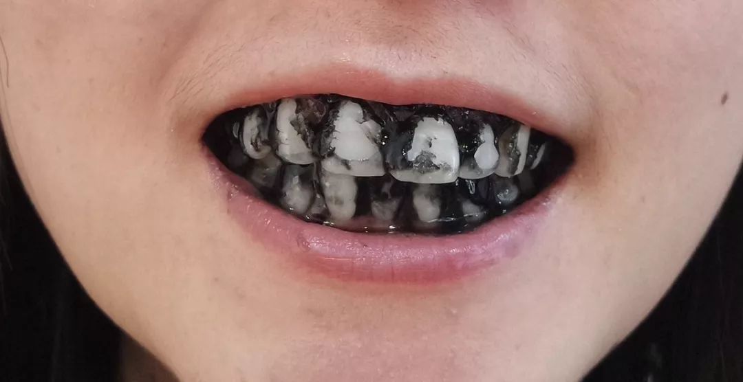 一口黄牙拉低颜值?这个黑乎乎的东西居然能一次让你的牙白3度!