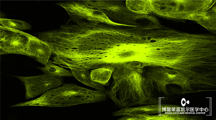 自体成纤维细胞除皱居然是这样的抗衰方式