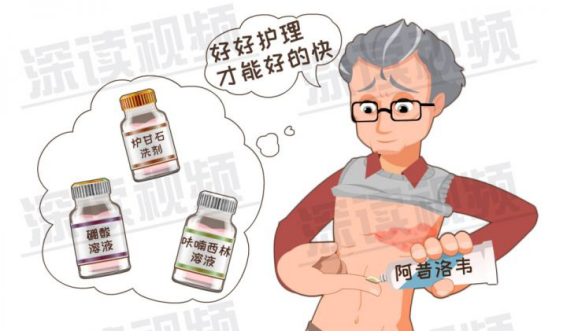 帶狀皰疹的誘因是什麼?如何有效治療?