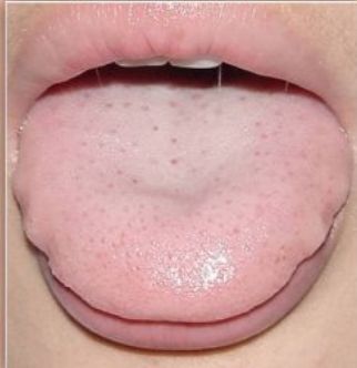 原创提醒若舌头出现2种现象可能是你湿邪缠身要及时祛湿了