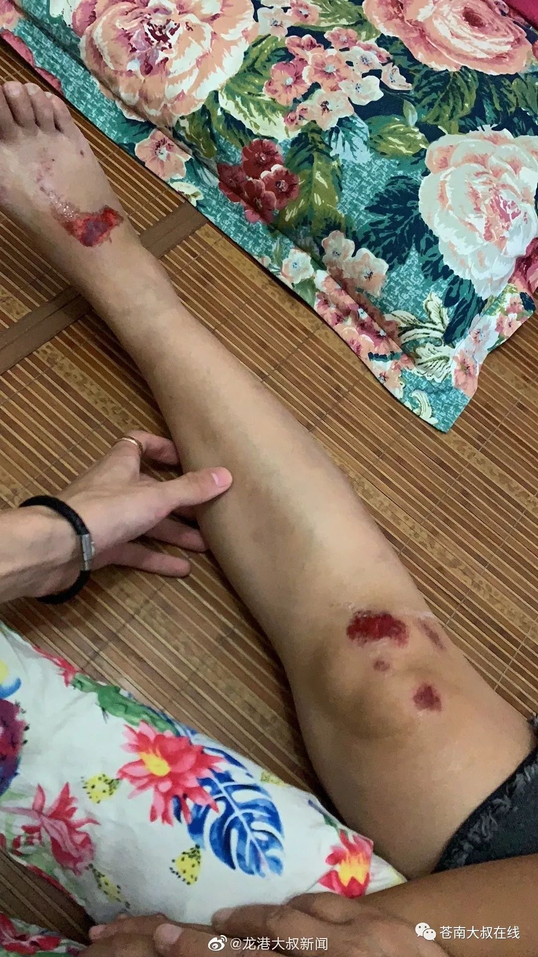 紧急扩散:钱库二人被撞,寻找目击者和肇事者