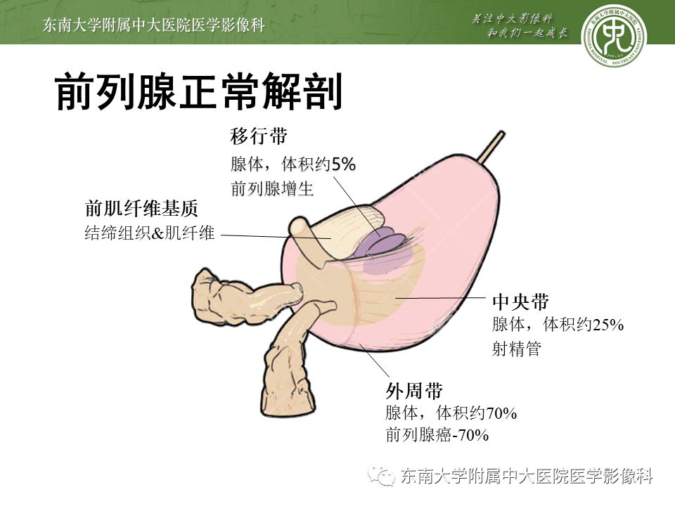 编辑/校对:郑孝飞 病例结果: 前列腺增生,前列腺炎 责任编辑