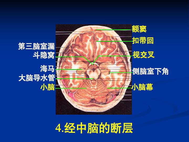 神经解剖脑室系统解剖及第三脑室病变常见手术入路南昌大学一附院徐春