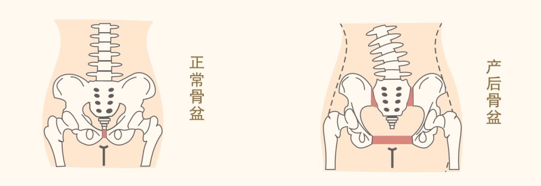 从而导致下腹突出,经常酸痛,阴道,肛门不能有效缩紧,易出现小便失禁.