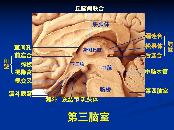 侧脑室与第三脑室图解图片