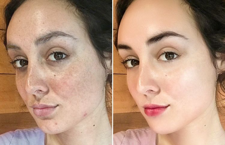 好物i 席卷欧美的"胶原抗衰"新潮流,逆天效果堪比换脸!