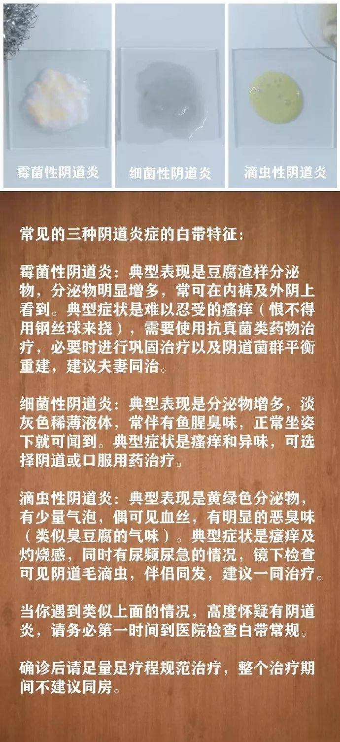 白带分泌物颜色对照图图片